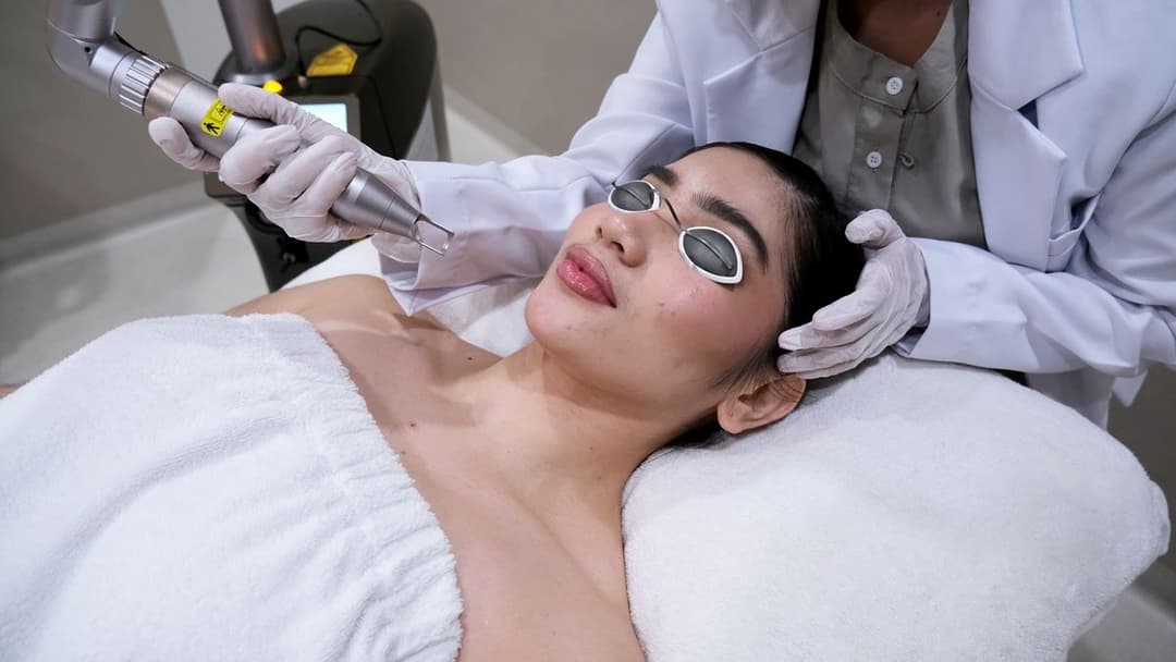  Ini Alasan Kenapa Banyak Orang Puas dengan Treatment Pico Laser