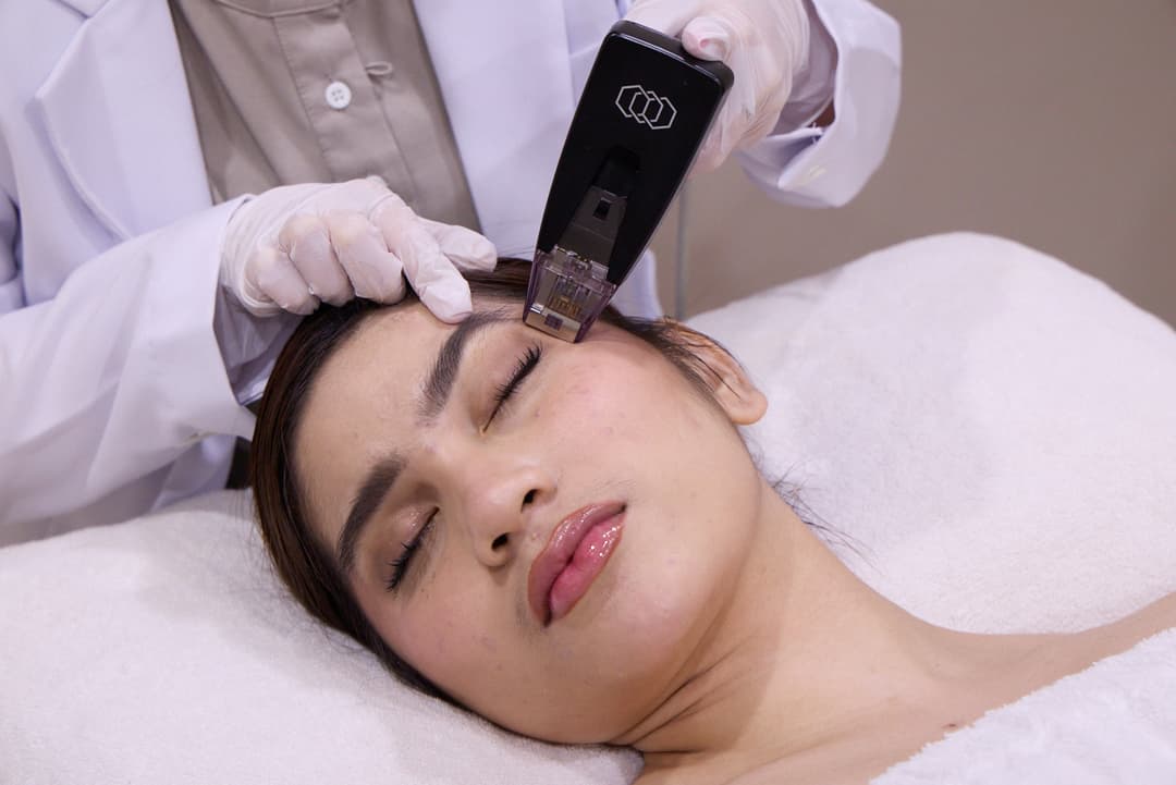 Ketahui Benefit Treatment Neck Lift dengan Morpheus8
