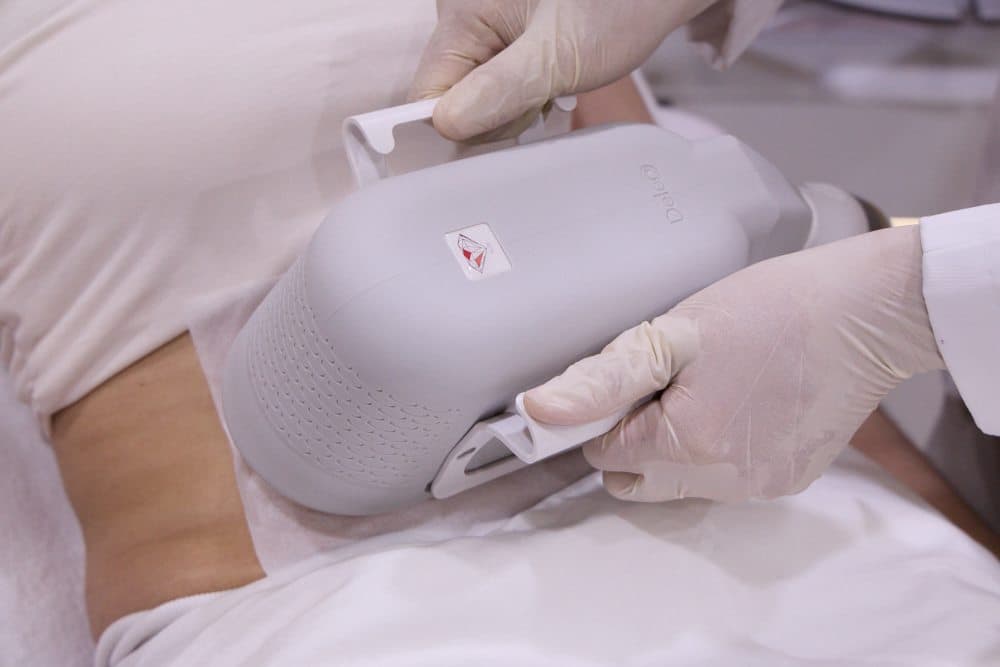 Cara Lipofreeze Mengecilkan Perut & Paha dengan Membekukan Lemak