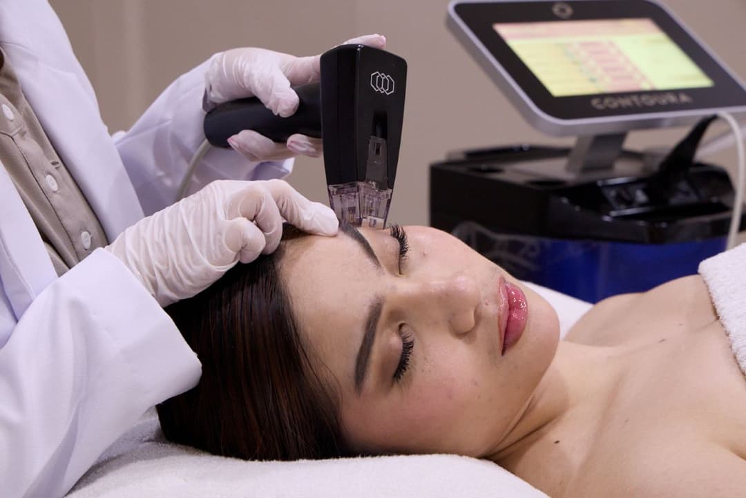 Seberapa Ampuh Morpheus8 Mengencangkan dan Menghaluskan Kulit Wajah?